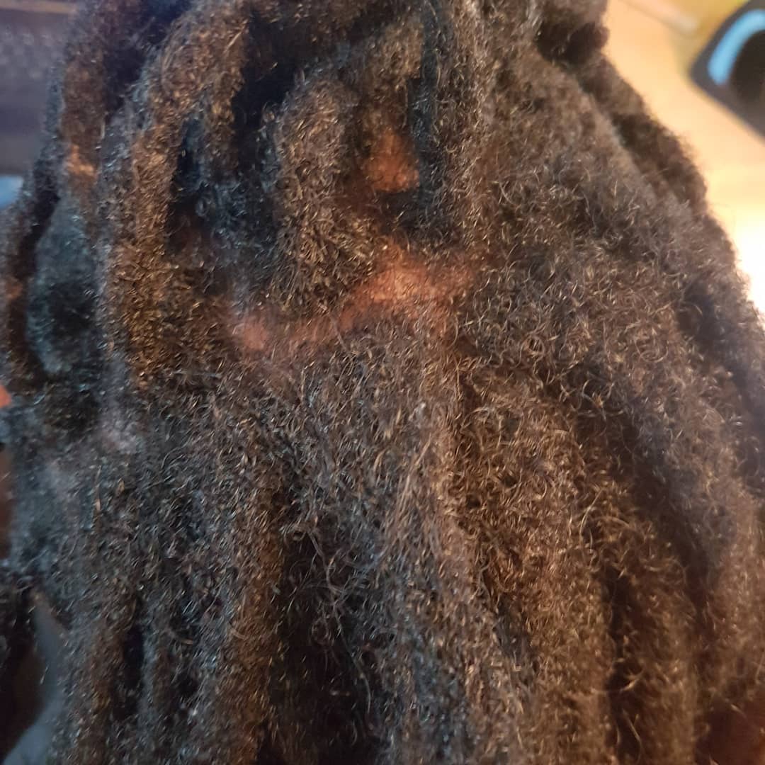 Ansatzpflege von Dreadlocks